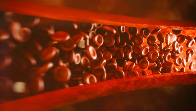 Managing Sickle Cell Anaemia with Your Diet