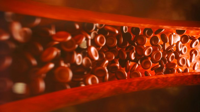 World Sickle Cell Day 2020: How to Manage Sickle Cell Anaemia with Your Diet?