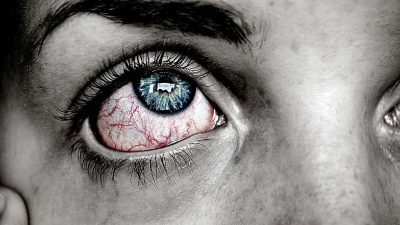 Erectile Dysfunction Cream Given Instead of Eye Drops to UK Woman Who Ends Up With Eye Injury