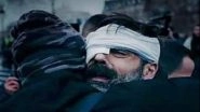 Yellow Vest Protests' Leader Hit in the Eye with Rubber Bullet, Maimed for Life