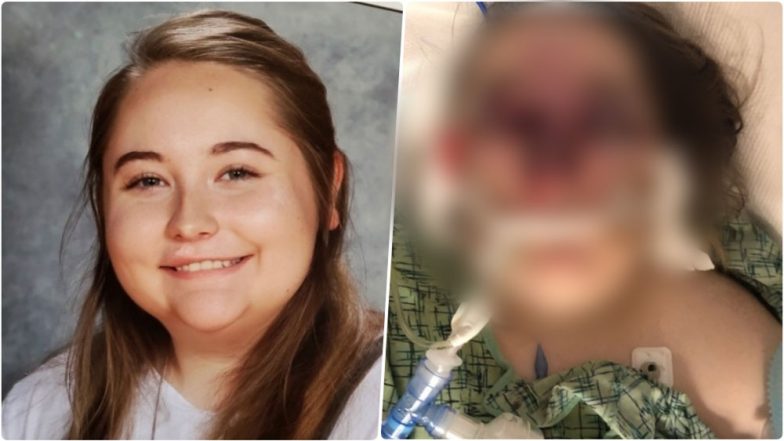 US Teen Becomes Blind after Returning from Family Cruise, Doctors Baffled by the Girl’s Mysterious Illness