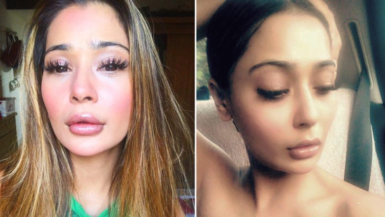Sara Khan's Lip Job Makes Her 'Ducktales' Ready; View Off-Putting Pics!
