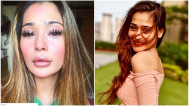 Trolls Call Sara Khan’s Lip Job Gone Wrong, Actress Shuts Them Down Like a Boss