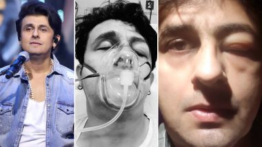 Sonu Nigam in ICU Due to Severe Seafood Allergy; Are You Intolerant To Fish? Read Causes, Symptoms and Treatment