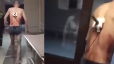 Nearly Naked Man With a Knife Sticking Out of His Back Walks out of Hospital For a Smoke (Watch Scary Video)