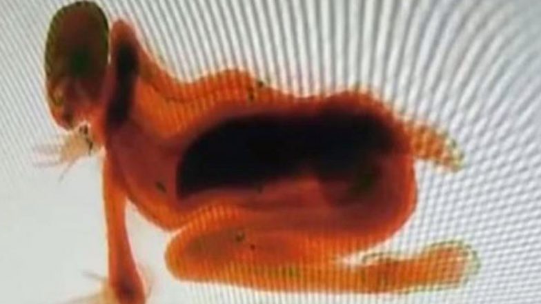 Woman Bored at Railway Station in China Sneaks Through Luggage X-Ray Machine (Watch Viral Video)