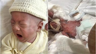 World’s Smallest Baby Boy Weighing 268 Grams Sent Home Healthy