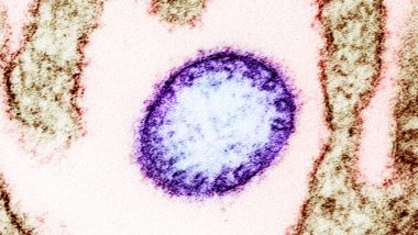 Nipah Vaccine: Japanese Scientists Strike 31-Million-Dollar Deal to Find Preventive Drug for the Brain-Damaging Disease
