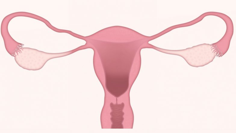 World Ovarian Cancer Day 2020: From Excess Body Weight to Old Age, Factors That Could Increase the Risk of This Deadly Cancer in Women!