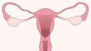 Woman Born Without Vagina Gets One Made out of Her Bowels: What is Mayer-Rokitansky-K&uuml;ster-Hauser Syndrome?