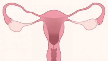 Woman Born Without Vagina Gets One Made out of Her Bowels: What is Mayer-Rokitansky-Küster-Hauser Syndrome?