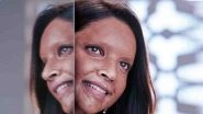 Deepika Padukone&rsquo;s Acid Attack Survivor Look From 'Chhapaak' Unveiled