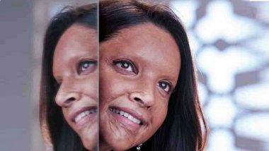 Deepika Padukone’s Acid Attack Survivor Look From 'Chhapaak' Unveiled