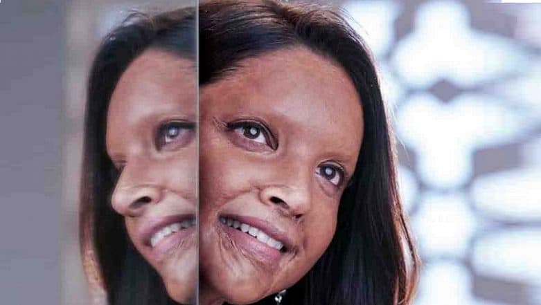 Deepika Padukone’s Acid Attack Survivor Look From 'Chhapaak' Unveiled Deepika Padukone’s Acid Attack Survivor Look From 'Chhapaak' Unveiled