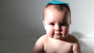 Summer Skin Care for Babies: Tips to Protect Baby Skin From Rising Heat