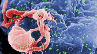 Second Man Goes into HIV Remission post Stem Cell Therapy