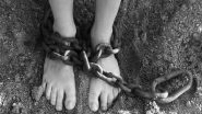 Brazillian Woman&rsquo;s Thighs Blackened Into Rotten Flesh After Days of Torture by Husband for Black Magic Ritual to Ward Off Evil