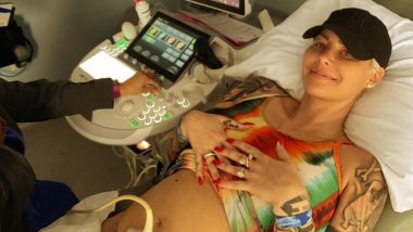 Amber Rose Suffers From Hyperemesis Gravidarum That Even Duchess Of Cambridge Kate Middleton Underwent During Her Pregnancies