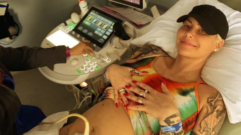 Amber Rose Suffers From Hyperemesis Gravidarum That Even Duchess Of Cambridge Kate Middleton Underwent During Her Pregnancies