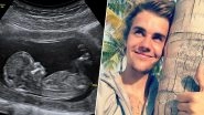 Justin Bieber Gets Slammed by Fans for Insensitivity After He Shared a Fake Pregnancy Post  on April Fool's Day