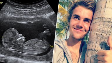 Justin Bieber Gets Slammed by Fans for Insensitivity After He Shared a Fake Pregnancy Post  on April Fool's Day