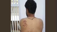 Muslim Prisoner Branded With &lsquo;Om&rsquo; Tattoo on Back in Delhi&rsquo;s Tihar Jail Shifted to Another Prison, Probe Underway