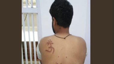 Muslim Prisoner Burn-Stamped ‘Om’ On Back in Delhi's Tihar Jail, Physically Assaulted; Court Orders Probe