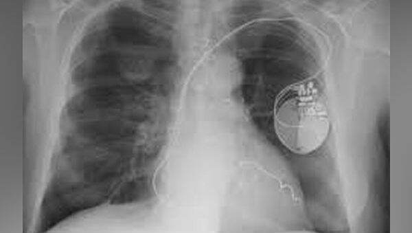 Radiotherapy Doubles the Survival Chances of Mesothelioma Cancer Patients Radiotherapy Doubles the Survival Chances of Mesothelioma Cancer Patients
