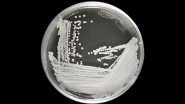Candida Auris: Scientists Shocked as &lsquo;Unbeatable&rsquo; Fungus Spreads Globally; 3 Reasons Why the Superbug is Bad News!