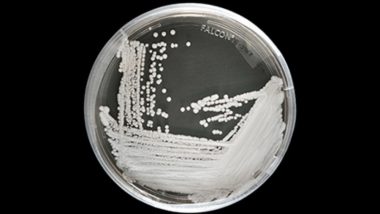 Candida Auris: Scientists Shocked as ‘Unbeatable’ Fungus Spreads Globally; 3 Reasons Why the Superbug is Bad News!