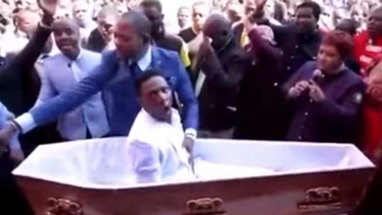 Man Who Rose From the Dead Months Ago Dies Again! Zimbabwean Who was ‘Resurrected’ in a Prank Passes Away For Real (Watch Video)