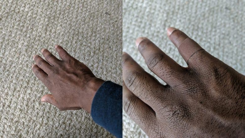 Man's Reaction on Finding a Bandage That Blends With His Skin Tone Goes Viral And Twitter Gets Teary Eyed Man's Reaction on Finding a Bandage That Blends With His Skin Tone Goes Viral And Twitter Gets Teary Eyed