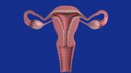 Woman&rsquo;s Uterus &lsquo;Slips&rsquo; out of Vagina after Dancing Too Hard; Everything About Uterine Prolapse You Need to Know