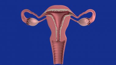 Woman’s Uterus ‘Slips’ out of Vagina after Dancing Too Hard; Everything About Uterine Prolapse You Need to Know