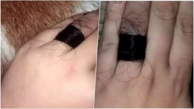 Girlfriend Shows Off Her Engagement Ring Made of Fiancé's Hair, People Left Disgusted (View Pic)
