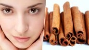 Cinnamon Benefits for Skin: How to Fight Acne and Fade Scars With This Fragrant Spice (Watch Video)
