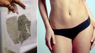 Vagina Made Out of Tilapia Fish Skin! World’s First Trans Woman With Fish Skin Genital Is Happy After the Reconstruction Surgery