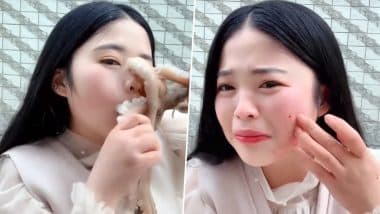 Revenge Served Cold! Chinese Blogger Attacked, Face Disfigured By Octopus While She Tried to Eat it Alive (Watch Viral Video)