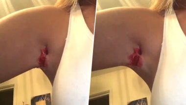 Woman’s Armpit Gets Glued To Body After Using Hot Wax at Home (Watch Video)