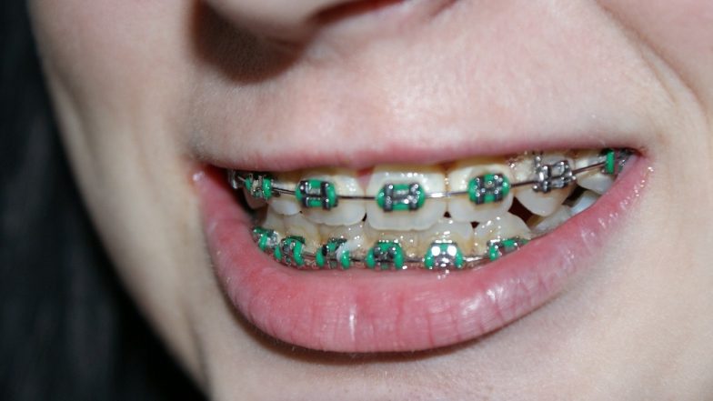 Braces Won’t Guarantee Happiness, Self-Confidence