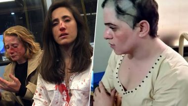 After Lesbians Get Bloodied in London, Trans Woman Attacked in Pakistan, Head Forcibly Shaved During Pride Month