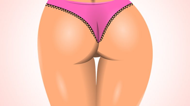 Mother Accidentally Sends Her 'Sunburnt Bum' Picture to Carpet Fitters!