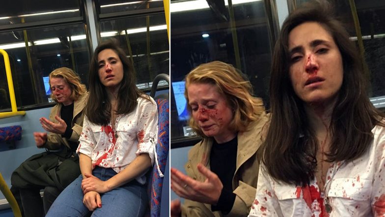 Lesbian Couple in London Attacked by Men For Refusing to Kiss Each Other; Woman’s Horrific Account Goes Viral