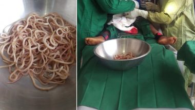 'Bundles' of Live Wriggly Worms Found in Constipated 4-Year-Old's Intestines in West Africa (View Pics)