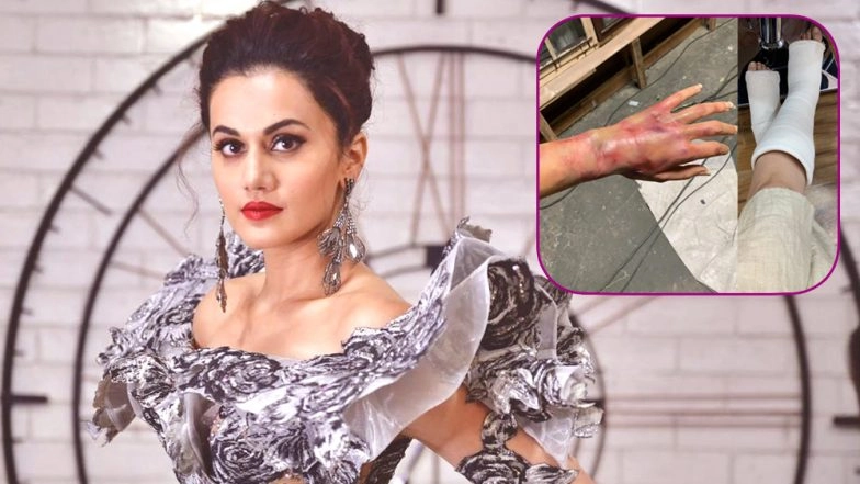 Taapsee Pannu Gets Seriously Injured on The Sets of 'Game Over', Actress Shares Pics