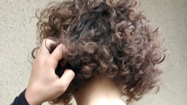Ball of Hair Removed From Ahmedabad Girl’s Stomach; All About Rapunzel Syndrome or Trichophagia – The Hair-Eating Disease
