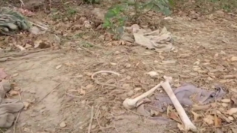 Bihar: 3-Member Panel to Probe Recovery of Human Skeletal Remains Behind SKMCH in Muzaffarpur