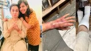 Keep Calm! Taapsee Pannu&rsquo;s Injured Hand on the Sets of Game Over Was Not for Real (View Pic)