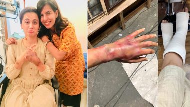 Keep Calm! Taapsee Pannu’s Injured Hand on the Sets of Game Over Was Not for Real (View Pic)