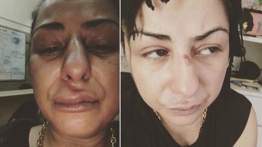 Rapper Hard Kaur Accuses Mo Joshi of Assault in a Shocking Instagram Post, the Accused Denies Allegations Says He's Open to Investigation